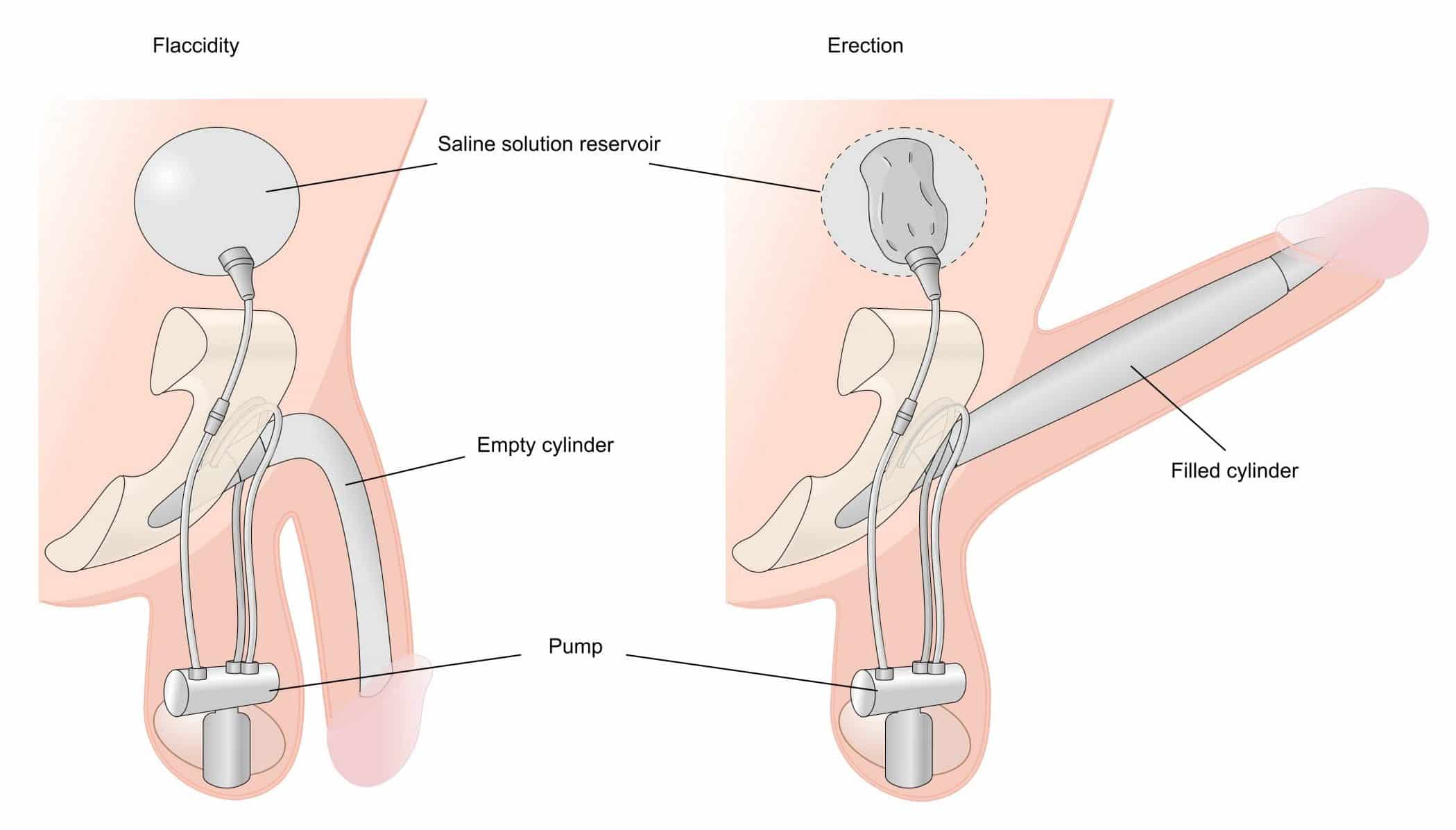 Effective Ways to Get Rid of Curvature at Home and Achieve Better Posture in 2025