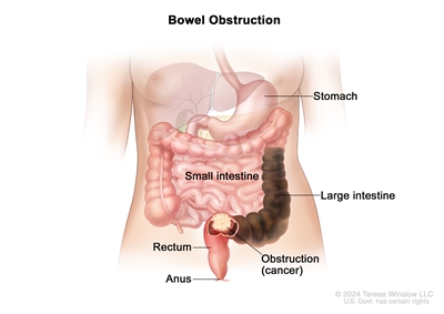 Effective Ways to Poop After Imodium: Discover Practical Solutions for Relief in 2025