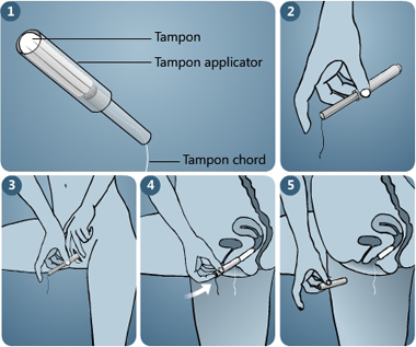 How to Properly Use Tampons: Essential Tips for Beginners in 2025